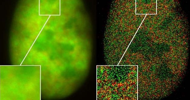 Nobelprijs voor supermicroscopie